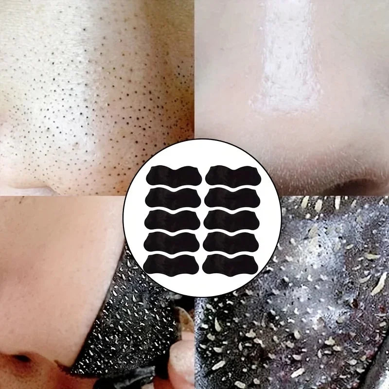 Blackhead Pore Strips